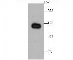 Complement Factor H Antibody in Western Blot (WB)