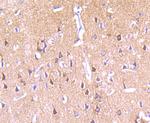 PKC epsilon Antibody in Immunohistochemistry (Paraffin) (IHC (P))