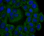 Calpain 2 Antibody in Immunocytochemistry (ICC/IF)