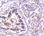 Calpain 2 Antibody in Immunohistochemistry (Paraffin) (IHC (P))