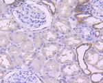 Calpain 2 Antibody in Immunohistochemistry (Paraffin) (IHC (P))