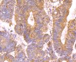 MUC4 Antibody in Immunohistochemistry (Paraffin) (IHC (P))