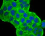 Fascin Antibody in Immunocytochemistry (ICC/IF)