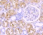 Fascin Antibody in Immunohistochemistry (Paraffin) (IHC (P))