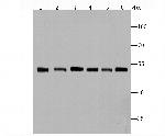 Fascin Antibody in Western Blot (WB)