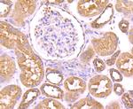 Dynamin 2 Antibody in Immunohistochemistry (Paraffin) (IHC (P))