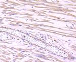 Dynamin 2 Antibody in Immunohistochemistry (Paraffin) (IHC (P))