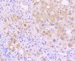 INSRR Antibody in Immunohistochemistry (Paraffin) (IHC (P))