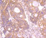 INSRR Antibody in Immunohistochemistry (Paraffin) (IHC (P))