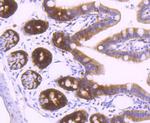 Thymidylate Synthase Antibody in Immunohistochemistry (Paraffin) (IHC (P))