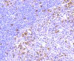 Thymidylate Synthase Antibody in Immunohistochemistry (Paraffin) (IHC (P))