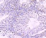 MYST2 Antibody in Immunohistochemistry (Paraffin) (IHC (P))