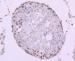 MYST2 Antibody in Immunohistochemistry (Paraffin) (IHC (P))