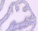 MYST2 Antibody in Immunohistochemistry (Paraffin) (IHC (P))