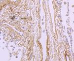 TGFBI Antibody in Immunohistochemistry (Paraffin) (IHC (P))