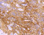 TGFBI Antibody in Immunohistochemistry (Paraffin) (IHC (P))