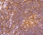 TUBA4A Antibody in Immunohistochemistry (Paraffin) (IHC (P))