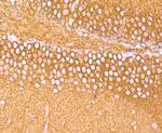 TUBA4A Antibody in Immunohistochemistry (Paraffin) (IHC (P))