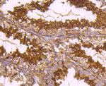 TUBA4A Antibody in Immunohistochemistry (Paraffin) (IHC (P))