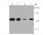 TUBA4A Antibody in Western Blot (WB)