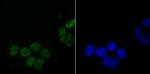 DDX5 Antibody in Immunocytochemistry (ICC/IF)