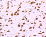 DDX5 Antibody in Immunohistochemistry (Paraffin) (IHC (P))