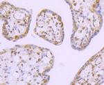 DDX5 Antibody in Immunohistochemistry (Paraffin) (IHC (P))