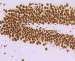 DDX5 Antibody in Immunohistochemistry (Paraffin) (IHC (P))