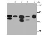 DDX5 Antibody in Western Blot (WB)