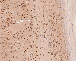 USP11 Antibody in Immunohistochemistry (Paraffin) (IHC (P))