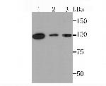 PKC mu Antibody in Western Blot (WB)