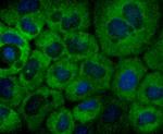 NFkB p100 Antibody in Immunocytochemistry (ICC/IF)