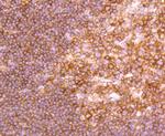 NFkB p100 Antibody in Immunohistochemistry (Paraffin) (IHC (P))