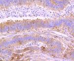 NFkB p100 Antibody in Immunohistochemistry (Paraffin) (IHC (P))