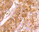 gamma Synuclein Antibody in Immunohistochemistry (Paraffin) (IHC (P))