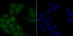 Phospho-ATM (Ser1981) Antibody in Immunocytochemistry (ICC/IF)