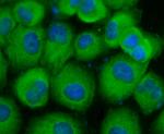 CD66e (CEA) Antibody in Immunocytochemistry (ICC/IF)