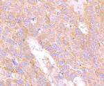 CD66e (CEA) Antibody in Immunohistochemistry (Paraffin) (IHC (P))