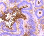 CD66e (CEA) Antibody in Immunohistochemistry (Paraffin) (IHC (P))