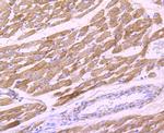 PDHB Antibody in Immunohistochemistry (Paraffin) (IHC (P))