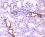 PDHB Antibody in Immunohistochemistry (Paraffin) (IHC (P))