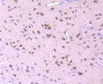 PDHB Antibody in Immunohistochemistry (Paraffin) (IHC (P))