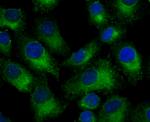 Nogo-B Antibody in Immunocytochemistry (ICC/IF)