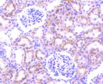 PFKFB3 Antibody in Immunohistochemistry (Paraffin) (IHC (P))