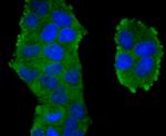 TXNIP Antibody in Immunocytochemistry (ICC/IF)