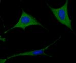 TXNIP Antibody in Immunocytochemistry (ICC/IF)