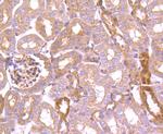 TXNIP Antibody in Immunohistochemistry (Paraffin) (IHC (P))