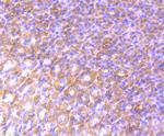 Alix Antibody in Immunohistochemistry (Paraffin) (IHC (P))