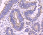 Alix Antibody in Immunohistochemistry (Paraffin) (IHC (P))