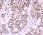 DNA ligase IV Antibody in Immunohistochemistry (Paraffin) (IHC (P))